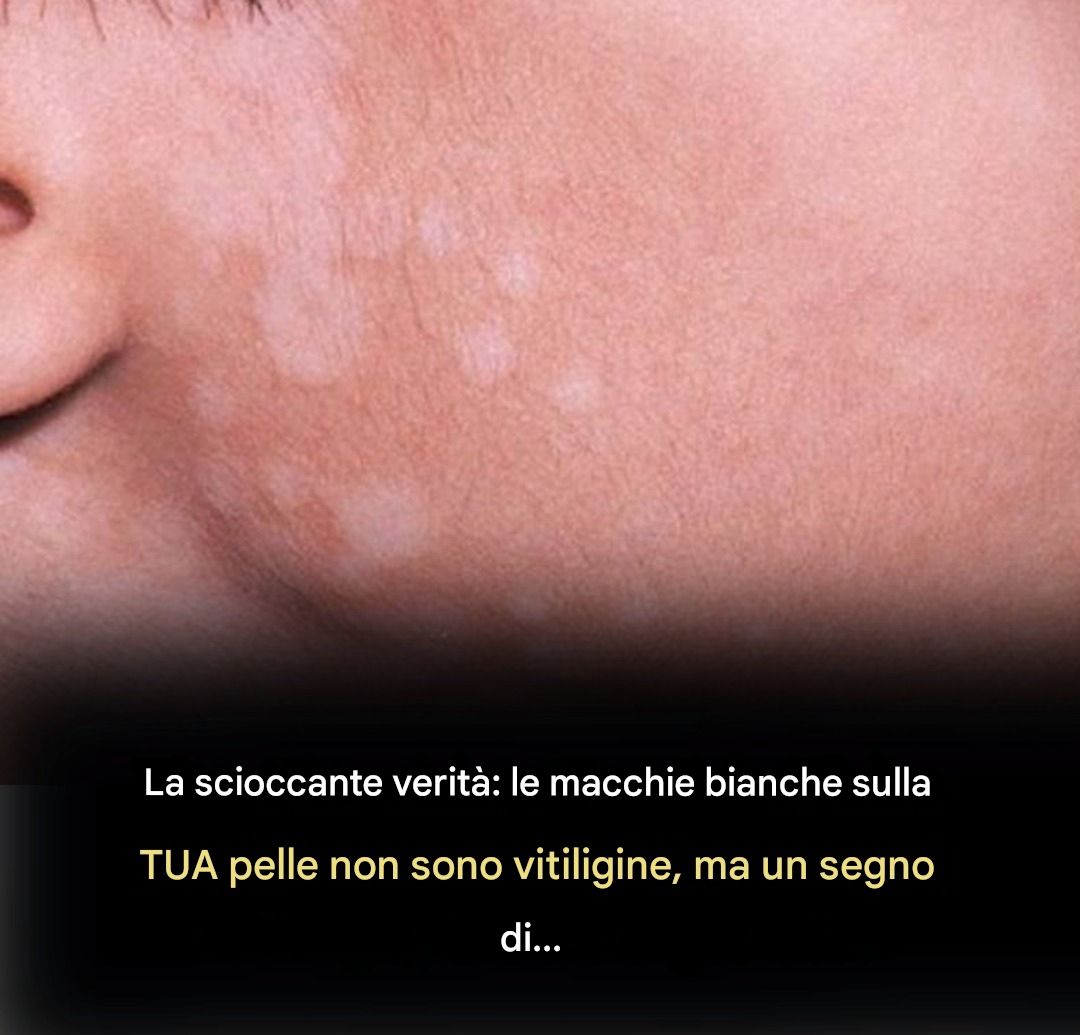 Esposizione al sole e alterazioni della pigmentazione: la verità nascosta dietro le piccole macchie bianche