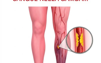 I coaguli di sangue sono molto più comuni di quanto si possa pensare… Ecco i segnali da riconoscere.