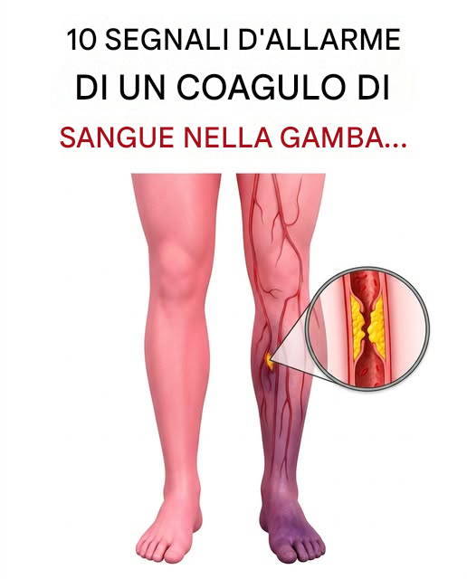 I coaguli di sangue sono molto più comuni di quanto si possa pensare… Ecco i segnali da riconoscere.