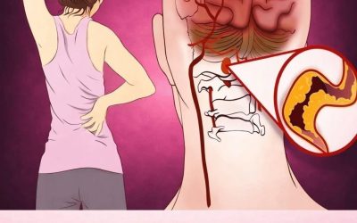 10 segnali precoci di ictus che tutti dovrebbero conoscere per intervenire tempestivamente,
