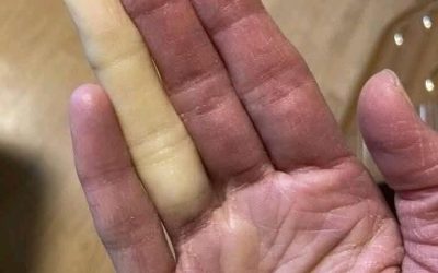 Ecco le conseguenze di dormire con un… Vedi altro