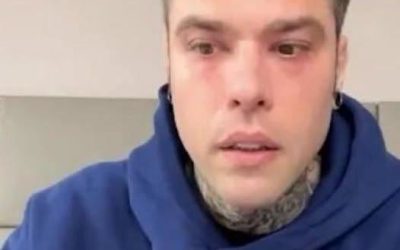 “Me l’hanno detto i medici”. Fedez, l’annuncio..Altro…
