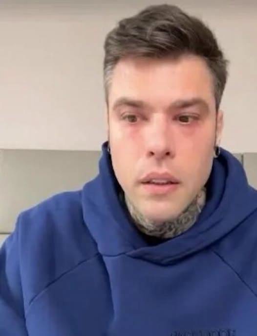 “Me l’hanno detto i medici”. Fedez, l’annuncio..Altro…